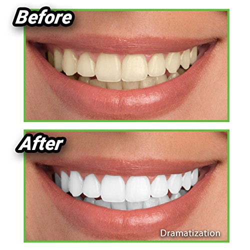 אונטל מלבן שיני פלא | אבקת פחם קוקוס של הלבנה טבעית | עדין על שיניים וחניכיים ומסיר כתמים הנגרמים